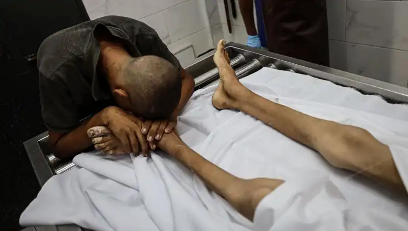 Gazze'de Acı Gerçek: Bir Çocuk Daha Açlıktan Hayatını Kaybetti