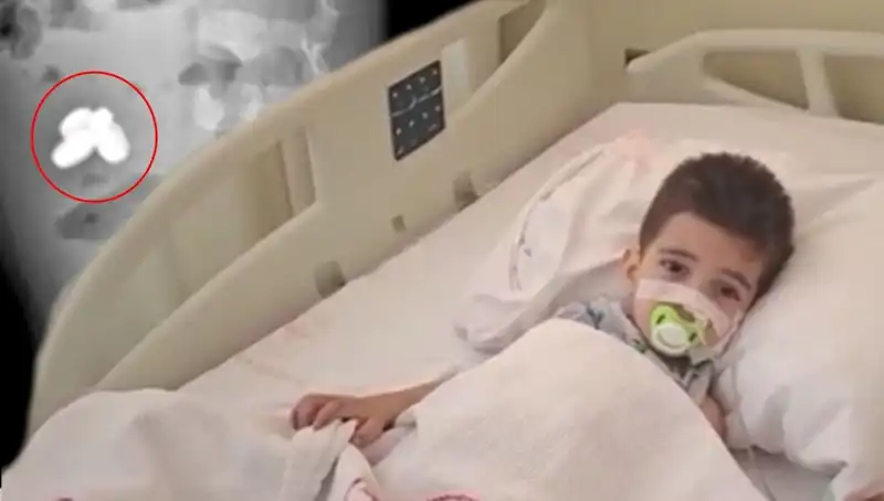 Mıknatıs ve Pil Yutan Çocuk: Sağlık Krizi ve Acil Müdahale Süreci