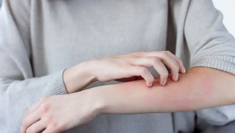 Cilt Kanserinin Gözden Kaçan İki Belirtisi: Dermatolog Açıklıyor